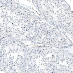 Integrin alpha 5/CD49e Antibody (CL6945), Novus Biologicals 100 &mu;L | Buy Online | Novus Biologicals | Fisher Scientific